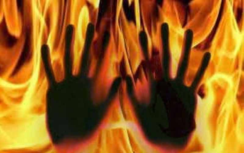 आग बुझाते वक्त फायर ब्रिगेड के 2 कर्मचारियों सहित झुलसा स्थानीय व्यक्ति, चंडीगढ़ रैफर