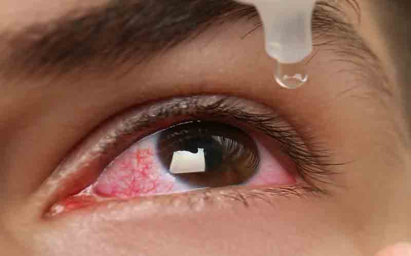 EYEDROP.jpg
