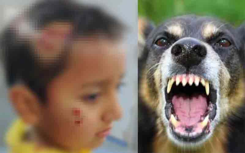 Pet-dog-bit-two-children-in.jpg