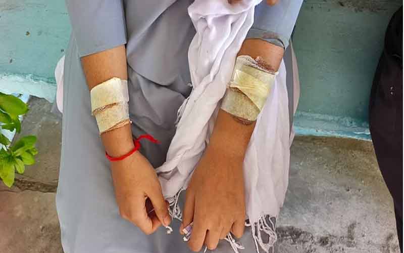 Schoolgirl-attacked,-masked